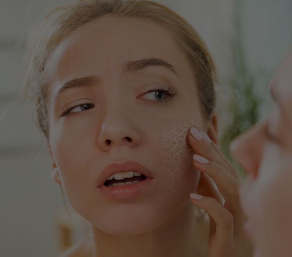 How to take care of Dry Skin & Dull Skin this Winter