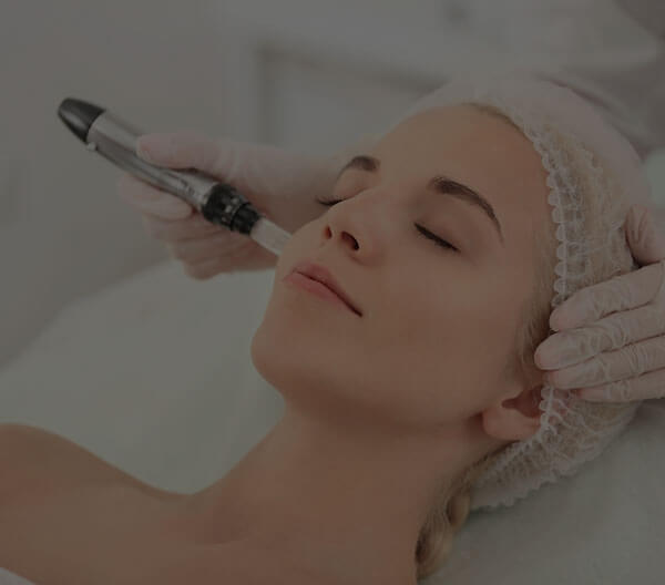 Why You Need To Know About Microneedling for Melasma