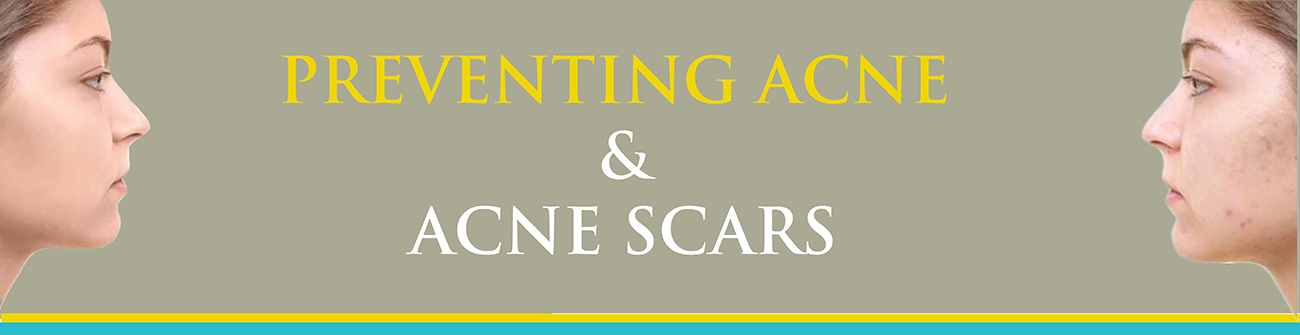 Laser Therapy Treatment for Acne & Acne Scars in Hyderabad